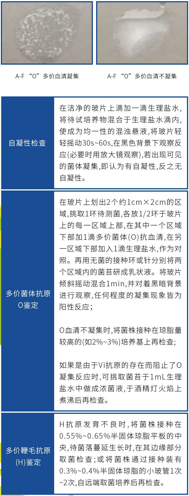 血清試驗